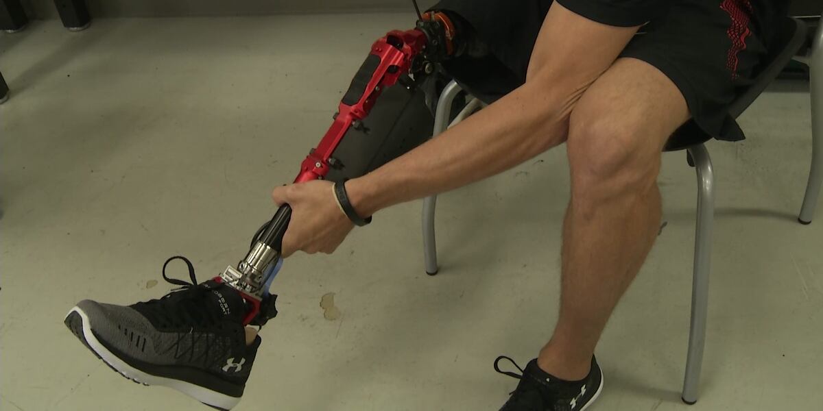 Medical Moment: World’s first truly bionic leg