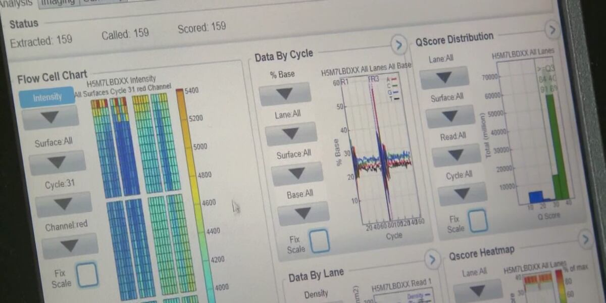 Blood test diagnoses stroke fast